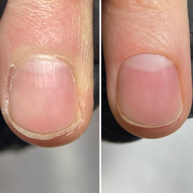 Before and after File Manicure™ — dry cuticles transformed into smooth, hydrated skin and clean nail edges.