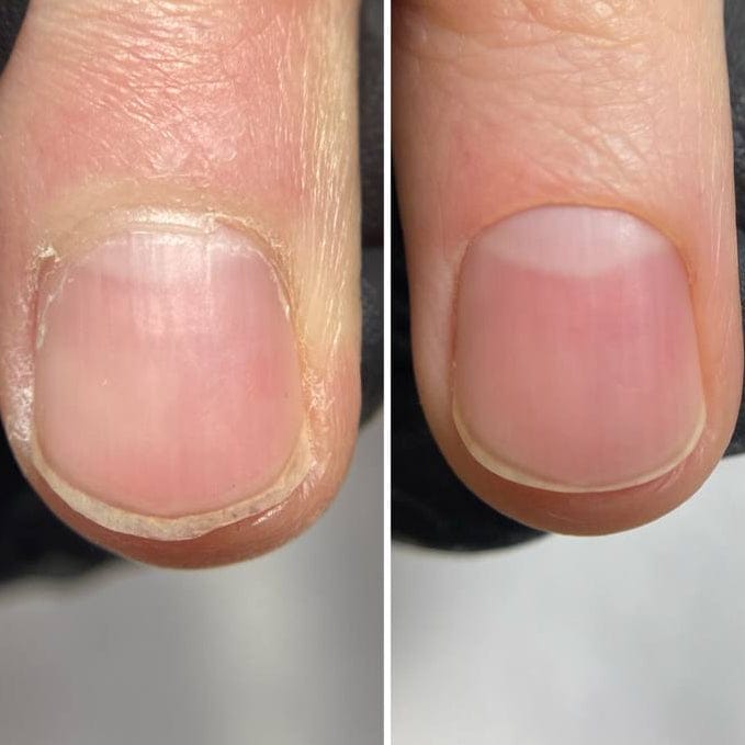Before and after File Manicure™ — dry cuticles transformed into smooth, hydrated skin and clean nail edges.