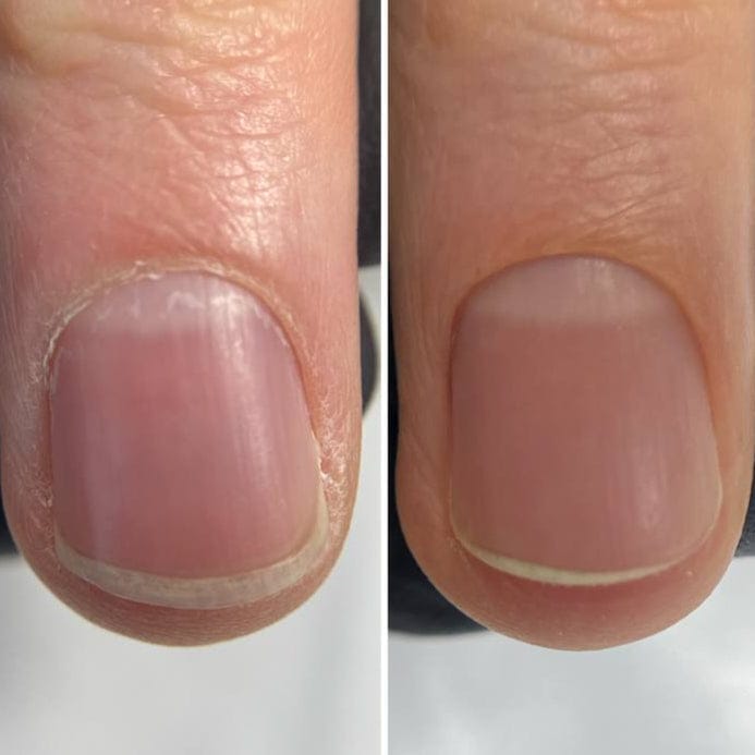 Dry, rough nail and cuticle before treatment compared to soft, even finish after File Manicure™ routine