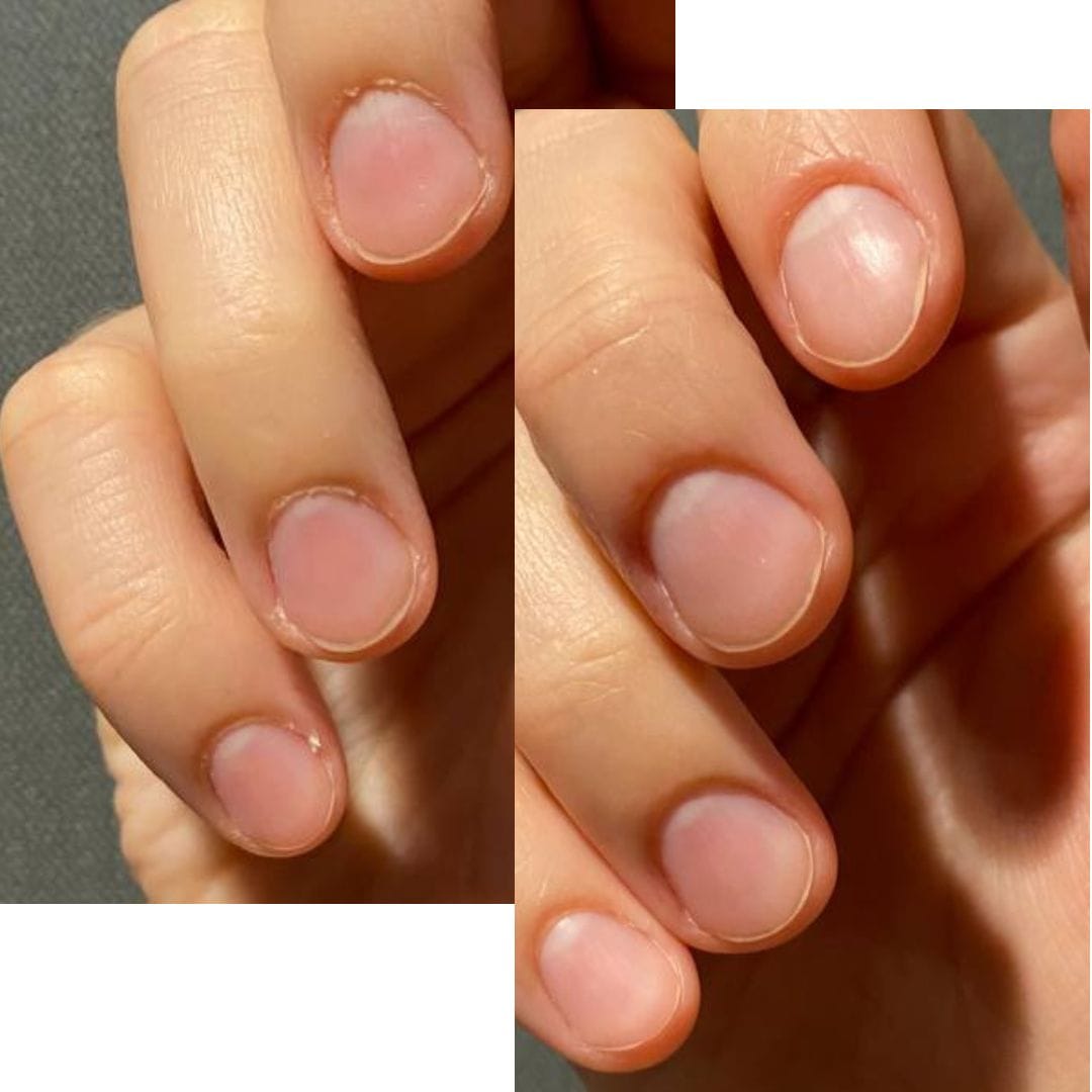 Comparison of untreated nail and nail after File Manicure™ — smoother texture, reduced dryness, and refined edges.