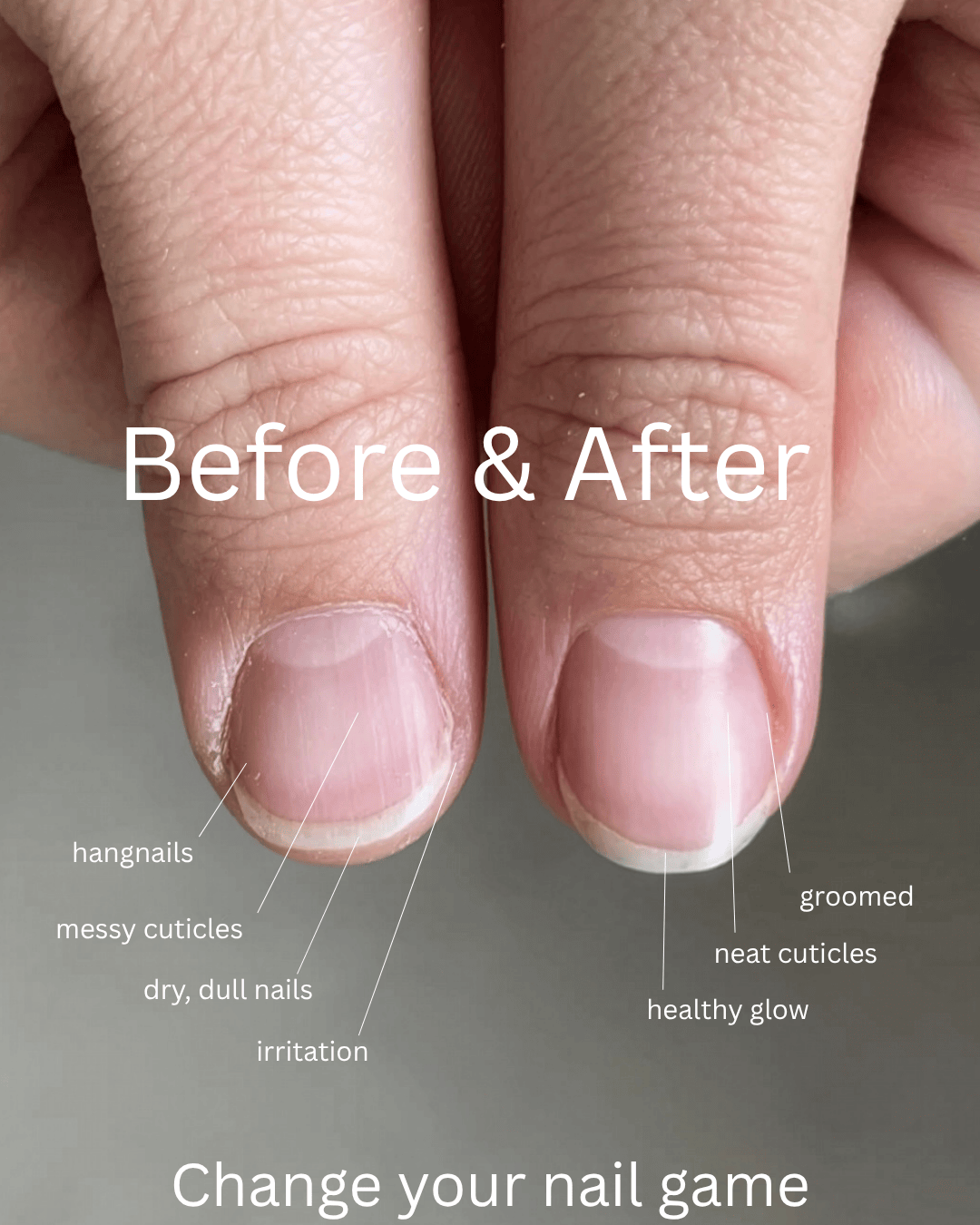 Fyle – Nail, Cuticle & Handcare. Carefully engineered for safe, clean manicures. Nail & Cuticle Care Kit The File Manicure™ Kit