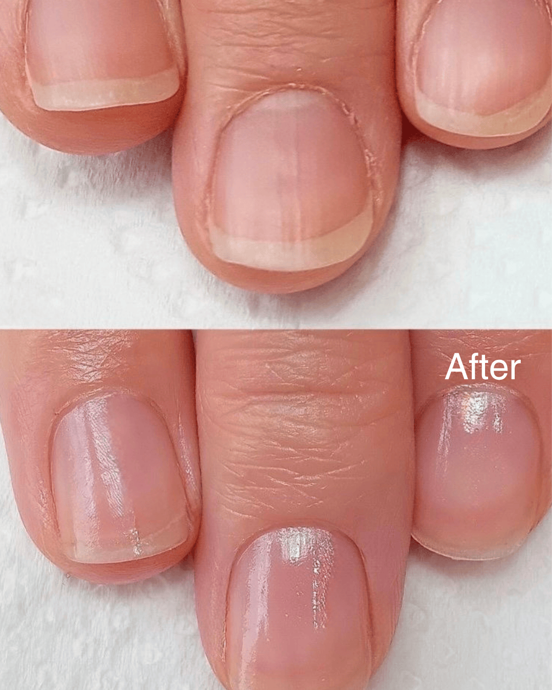 Fyle – Nail, Cuticle & Handcare. Carefully engineered for safe, clean manicures. Nail & Cuticle Care Kit The File Manicure™ Kit