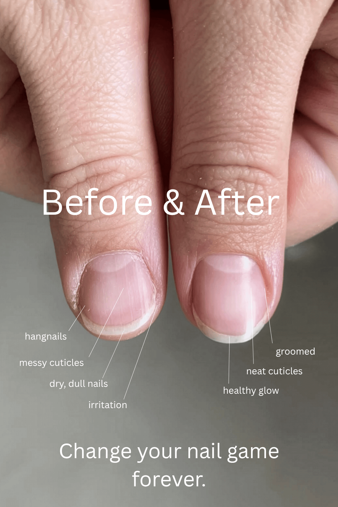Fyle – Nail, Cuticle & Handcare. Carefully engineered for safe, clean manicures. Nail & Cuticle Care Kit The File Manicure™ Kit