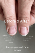 Fyle – Nail, Cuticle & Handcare. Carefully engineered for safe, clean manicures. Nail & Cuticle Care Kit The File Manicure™ Kit